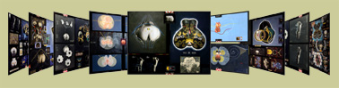 Commander votre toile / Order your canvas
